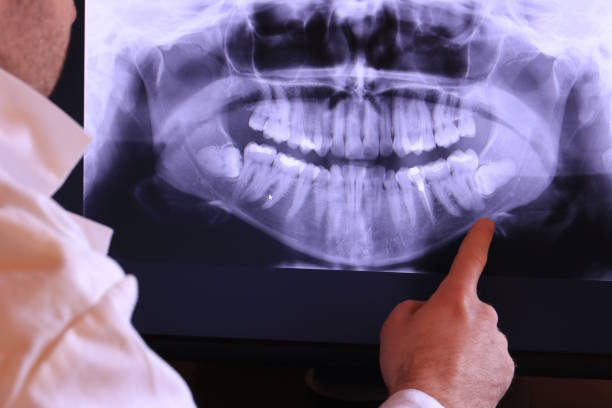 Best Chipped Tooth Repair Near Me  in Smithfield, UT